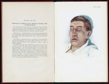 plate_iii_pallid_wh246s18x_12579s58c_dl_full_size